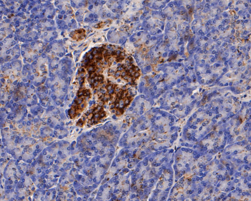 Immunohistochemical analysis of paraffin-embedded human pancreas tissue using anti-Kidins220 antibody. The section was pre-treated using heat mediated antigen retrieval with Tris-EDTA buffer (pH 8.0-8.4) for 20 minutes.The tissues were blocked in 5% BSA for 30 minutes at room temperature, washed with ddH2O and PBS, and then probed with the primary antibody (ER1902-65, 1/50) for 30 minutes at room temperature. The detection was performed using an HRP conjugated compact polymer system. DAB was used as the chromogen. Tissues were counterstained with hematoxylin and mounted with DPX.