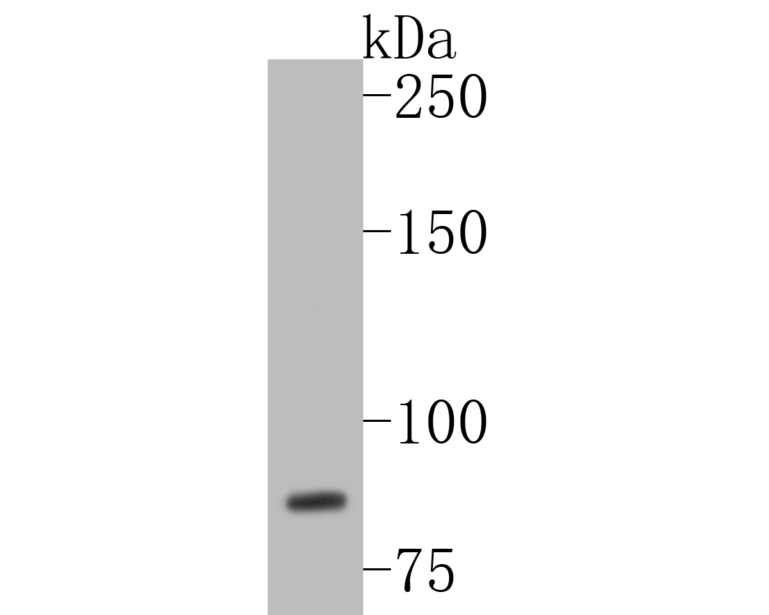 Western blot analysis of WDR70 on Hela cell lysates. Proteins were transferred to a PVDF membrane and blocked with 5% BSA in PBS for 1 hour at room temperature. The primary antibody (ER1902-66, 1/500) was used in 5% BSA at room temperature for 2 hours. Goat Anti-Rabbit IgG - HRP Secondary Antibody (HA1001) at 1:5,000 dilution was used for 1 hour at room temperature.