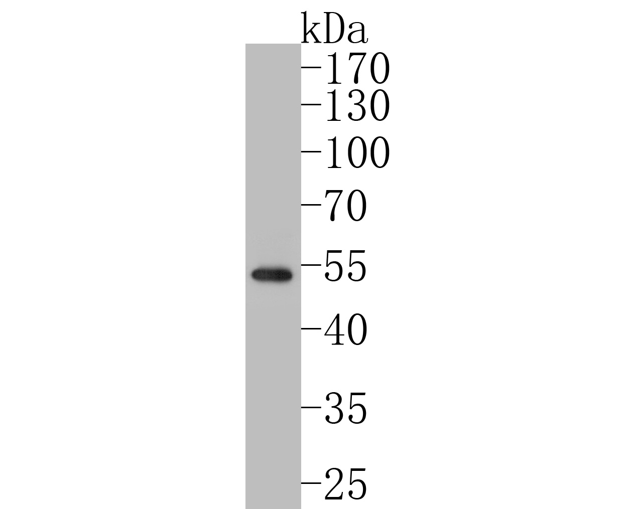 Western blot analysis of GATA3 on SH-SY5Y cell lysates. Proteins were transferred to a PVDF membrane and blocked with 5% BSA in PBS for 1 hour at room temperature. The primary antibody (ER1902-69, 1/500) was used in 5% BSA at room temperature for 2 hours. Goat Anti-Rabbit IgG - HRP Secondary Antibody (HA1001) at 1:5,000 dilution was used for 1 hour at room temperature.