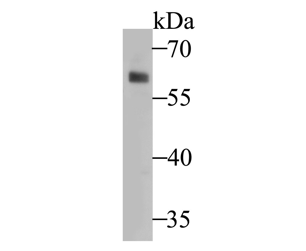Western blot analysis of TRF2 on A549 cell lysate. Proteins were transferred to a PVDF membrane and blocked with 5% BSA in PBS for 1 hour at room temperature. The primary antibody was used at a 1:1,000 dilution in 5% BSA at room temperature for 2 hours. Goat Anti-Rabbit IgG - HRP Secondary Antibody (HA1001) at 1:5,000 dilution was used for 1 hour at room temperature.