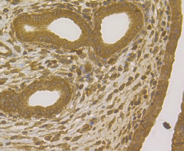 ICC staining of TRF2 in LOVO cells (green). Formalin fixed cells were permeabilized with 0.1% Triton X-100 in TBS for 10 minutes at room temperature and blocked with 1% Blocker BSA for 15 minutes at room temperature. Cells were probed with the primary antibody (ER1902-70, 1/100) for 1 hour at room temperature, washed with PBS. Alexa Fluor®488 Goat anti-Rabbit IgG was used as the secondary antibody at 1/200 dilution. The nuclear counter stain is DAPI (blue).