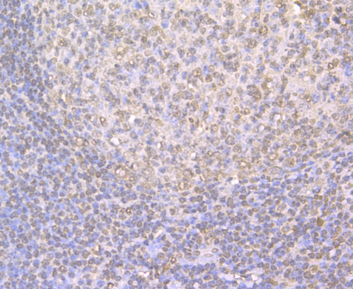 Immunohistochemical analysis of paraffin-embedded rat uterus tissue using anti-TRF2 antibody. The section was pre-treated using heat mediated antigen retrieval with sodium citrate buffer (pH 6.0) for 20 minutes. The tissues were blocked in 5% BSA for 30 minutes at room temperature, washed with ddH2O and PBS, and then probed with the antibody (ER1902-70) at 1/50 dilution, for 30 minutes at room temperature and detected using an HRP conjugated compact polymer system. DAB was used as the chromogen. Counter stained with hematoxylin and mounted with DPX.