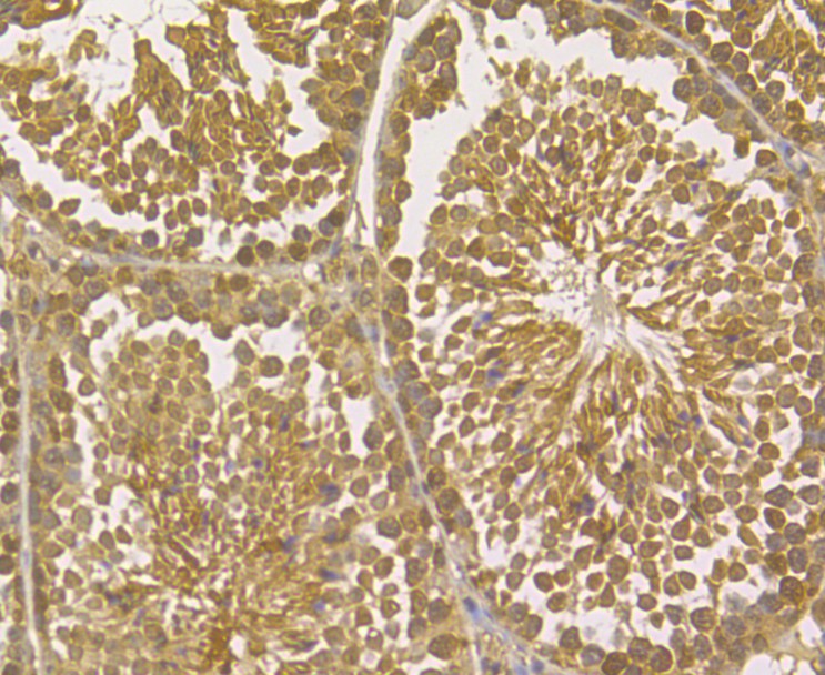 Immunohistochemical analysis of paraffin-embedded human tonsil tissue using anti-TRF2 antibody. The section was pre-treated using heat mediated antigen retrieval with sodium citrate buffer (pH 6.0) for 20 minutes. The tissues were blocked in 5% BSA for 30 minutes at room temperature, washed with ddH2O and PBS, and then probed with the antibody (ER1902-70) at 1/50 dilution, for 30 minutes at room temperature and detected using an HRP conjugated compact polymer system. DAB was used as the chromogen. Counter stained with hematoxylin and mounted with DPX.