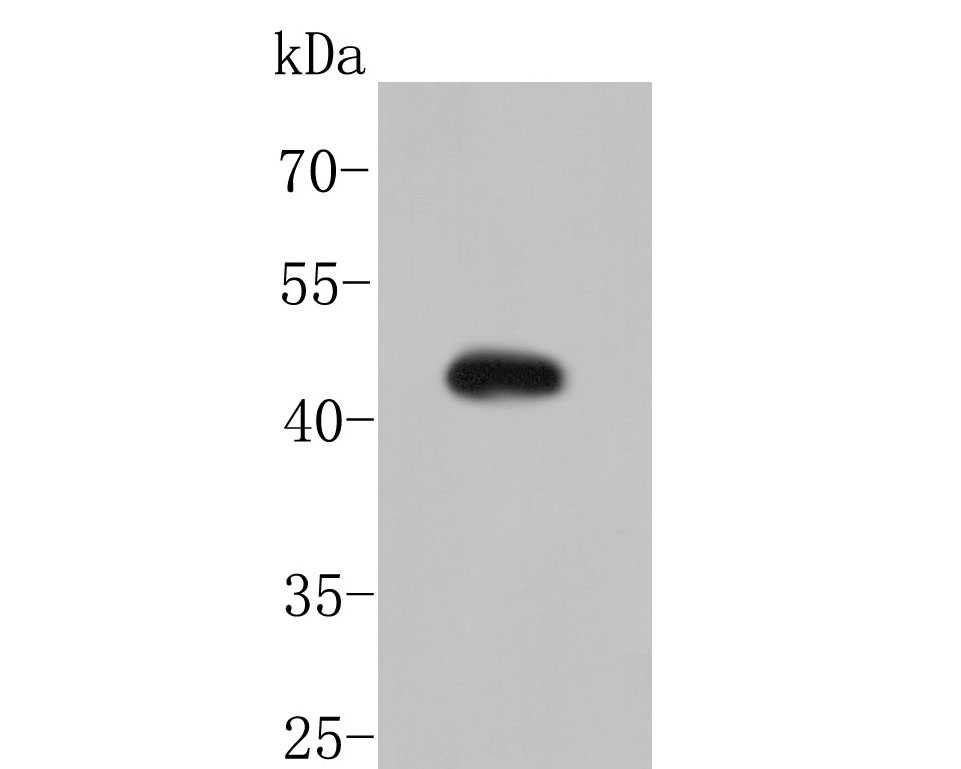 Western blot analysis of MSR1 on hela cell lysate. Proteins were transferred to a PVDF membrane and blocked with 5% BSA in PBS for 1 hour at room temperature. The primary antibody (ER1902-71, 1/500) was used in 5% BSA at room temperature for 2 hours. Goat Anti-Rabbit IgG - HRP Secondary Antibody (HA1001) at 1:5,000 dilution was used for 1 hour at room temperature.
