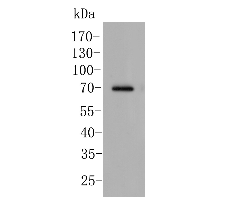 Western blot analysis of CDK5RAP3 on MCF-7 cell lysates. Proteins were transferred to a PVDF membrane and blocked with 5% BSA in PBS for 1 hour at room temperature. The primary antibody (ER1902-72, 1/500) was used in 5% BSA at room temperature for 2 hours. Goat Anti-Rabbit IgG - HRP Secondary Antibody (HA1001) at 1:5,000 dilution was used for 1 hour at room temperature.