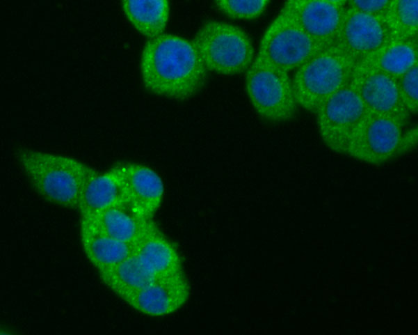 ICC staining of CDK5RAP3 in LOVO cells (green). Formalin fixed cells were permeabilized with 0.1% Triton X-100 in TBS for 10 minutes at room temperature and blocked with 1% Blocker BSA for 15 minutes at room temperature. Cells were probed with the primary antibody (ER1902-72, 1/100) for 1 hour at room temperature, washed with PBS. Alexa Fluor®488 Goat anti-Rabbit IgG was used as the secondary antibody at 1/100 dilution. The nuclear counter stain is DAPI (blue).