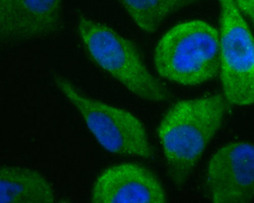 ICC staining of CDK5RAP3 in PC-3M cells (green). Formalin fixed cells were permeabilized with 0.1% Triton X-100 in TBS for 10 minutes at room temperature and blocked with 1% Blocker BSA for 15 minutes at room temperature. Cells were probed with the primary antibody (ER1902-72, 1/100) for 1 hour at room temperature, washed with PBS. Alexa Fluor®488 Goat anti-Rabbit IgG was used as the secondary antibody at 1/100 dilution. The nuclear counter stain is DAPI (blue).