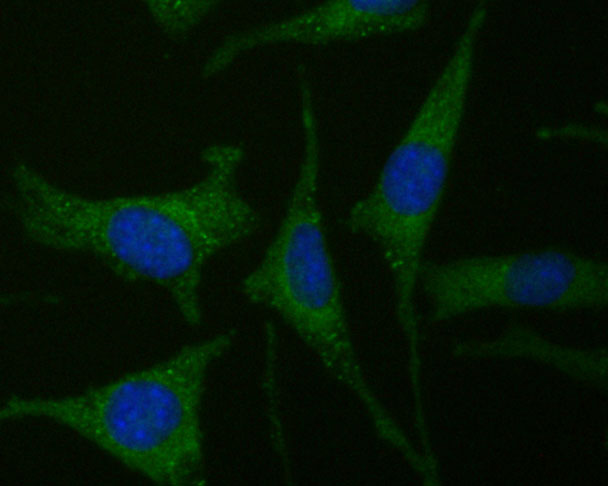 ICC staining of CDK5RAP3 in SHSY5Y cells (green). Formalin fixed cells were permeabilized with 0.1% Triton X-100 in TBS for 10 minutes at room temperature and blocked with 1% Blocker BSA for 15 minutes at room temperature. Cells were probed with the primary antibody (ER1902-72, 1/100) for 1 hour at room temperature, washed with PBS. Alexa Fluor®488 Goat anti-Rabbit IgG was used as the secondary antibody at 1/100 dilution. The nuclear counter stain is DAPI (blue).