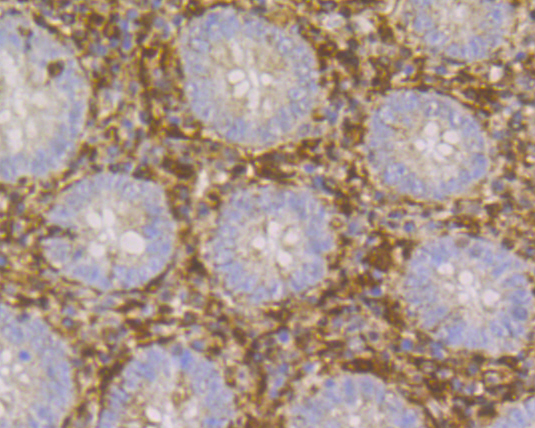Immunohistochemical analysis of paraffin-embedded human appendix tissue using anti-Thymidine Phosphorylase antibody. The section was pre-treated using heat mediated antigen retrieval with Tris-EDTA buffer (pH 8.0-8.4) for 20 minutes.The tissues were blocked in 5% BSA for 30 minutes at room temperature, washed with ddH2O and PBS, and then probed with the primary antibody (ER1902-79, 1/400) for 30 minutes at room temperature. The detection was performed using an HRP conjugated compact polymer system. DAB was used as the chromogen. Tissues were counterstained with hematoxylin and mounted with DPX.