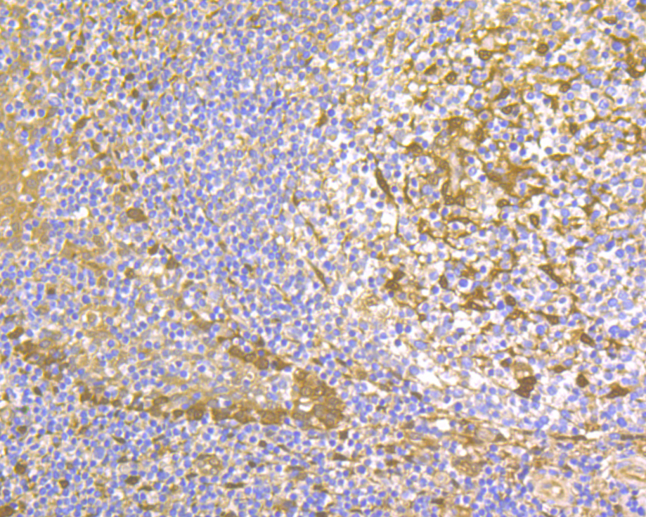 Immunohistochemical analysis of paraffin-embedded human tonsil tissue using anti-Thymidine Phosphorylase antibody. The section was pre-treated using heat mediated antigen retrieval with Tris-EDTA buffer (pH 8.0-8.4) for 20 minutes.The tissues were blocked in 5% BSA for 30 minutes at room temperature, washed with ddH2O and PBS, and then probed with the primary antibody (ER1902-79, 1/400) for 30 minutes at room temperature. The detection was performed using an HRP conjugated compact polymer system. DAB was used as the chromogen. Tissues were counterstained with hematoxylin and mounted with DPX.