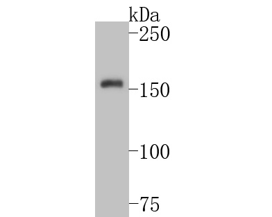 Western blot analysis of TRPM4 on SK-Br-3 cell lysates. Proteins were transferred to a PVDF membrane and blocked with 5% BSA in PBS for 1 hour at room temperature. The primary antibody (ER1902-81, 1/500) was used in 5% BSA at room temperature for 2 hours. Goat Anti-Rabbit IgG - HRP Secondary Antibody (HA1001) at 1:5,000 dilution was used for 1 hour at room temperature.