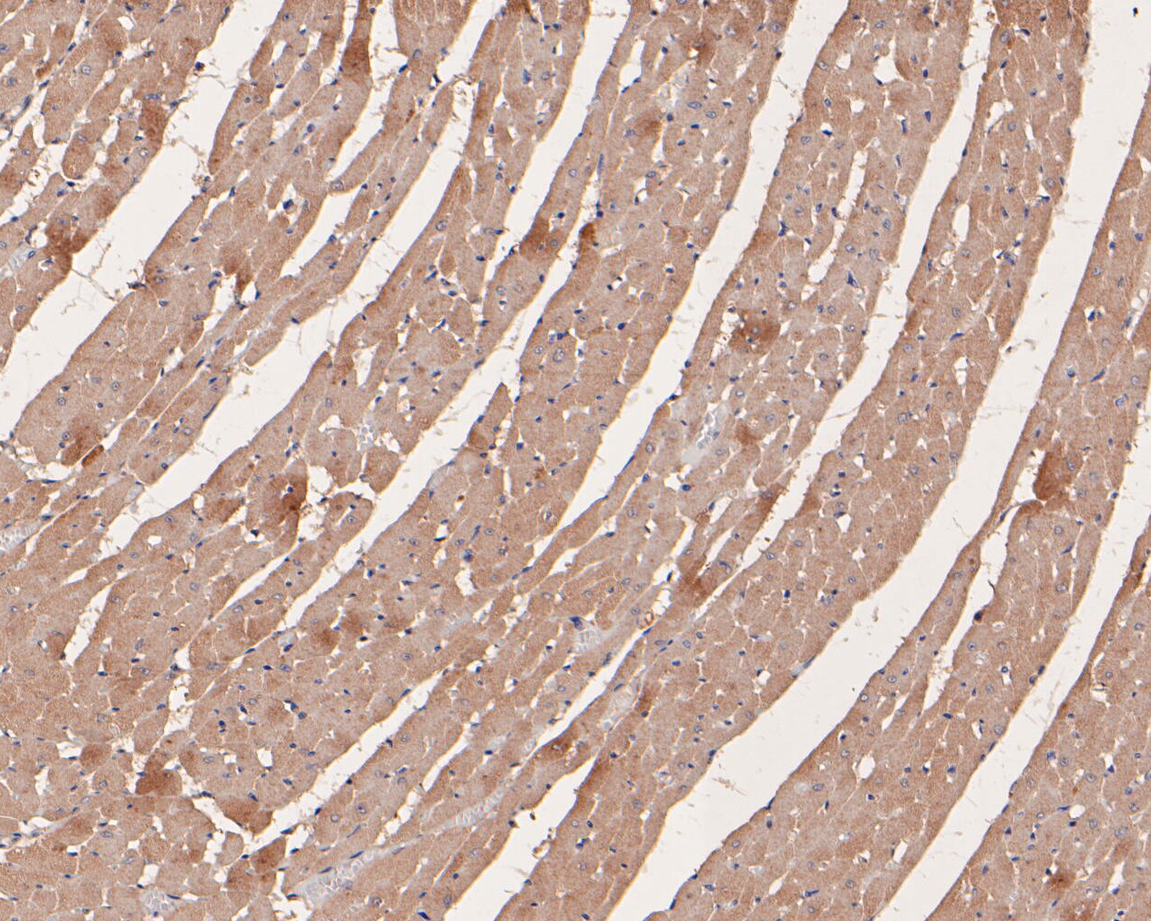 Immunohistochemical analysis of paraffin-embedded rat heart tissue using anti-TRPM4 antibody. The section was pre-treated using heat mediated antigen retrieval with Tris-EDTA buffer (pH 8.0-8.4) for 20 minutes.The tissues were blocked in 5% BSA for 30 minutes at room temperature, washed with ddH2O and PBS, and then probed with the primary antibody (ER1902-81, 1/50) for 30 minutes at room temperature. The detection was performed using an HRP conjugated compact polymer system. DAB was used as the chromogen. Tissues were counterstained with hematoxylin and mounted with DPX.