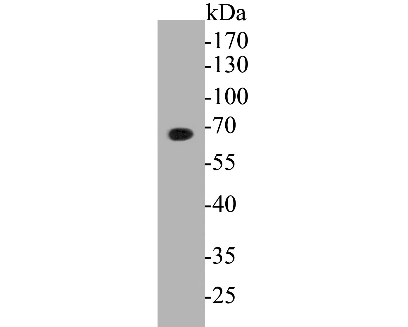 Western blot analysis of GABRA5 on rat brain tissue lysates. Proteins were transferred to a PVDF membrane and blocked with 5% BSA in PBS for 1 hour at room temperature. The primary antibody (ER1902-82, 1/500) was used in 5% BSA at room temperature for 2 hours. Goat Anti-Rabbit IgG - HRP Secondary Antibody (HA1001) at 1:5,000 dilution was used for 1 hour at room temperature.