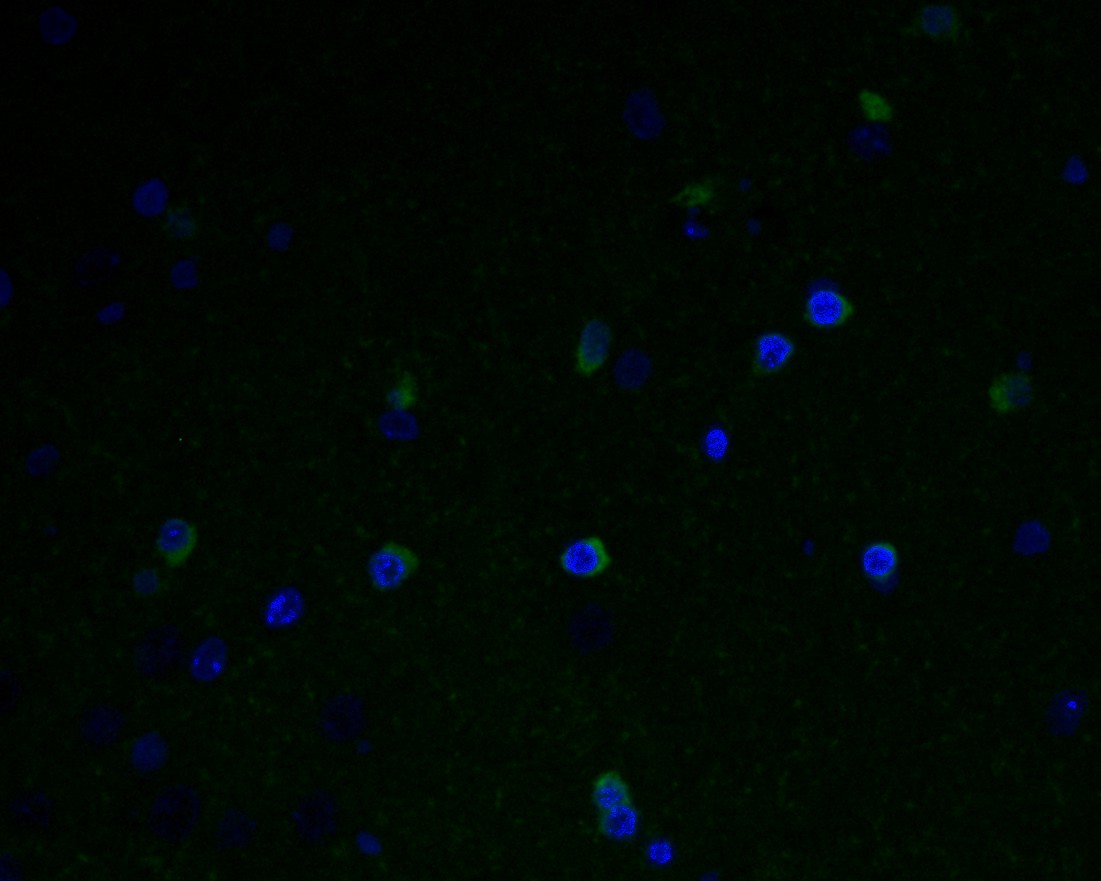 Immunofluorescence staining of paraffin- embedded rat brain tissue using anti-GABRA5 rabbit polyclonal antibody.The section was pre-treated using heat mediated antigen retrieval with Tris-EDTA buffer (pH 9.0) for 20 minutes. The tissues were blocked in 10% negative goat serum for 1 hour at room temperature, washed with PBS, and then probed with ER1902-82 at 1/50 dilution for 10 hours at 4℃ and detected using Alexa Fluor® 488 conjugate-Goat anti-Rabbit IgG (H+L) Secondary Antibody at a dilution of 1:500 for 1 hour at room temperature.