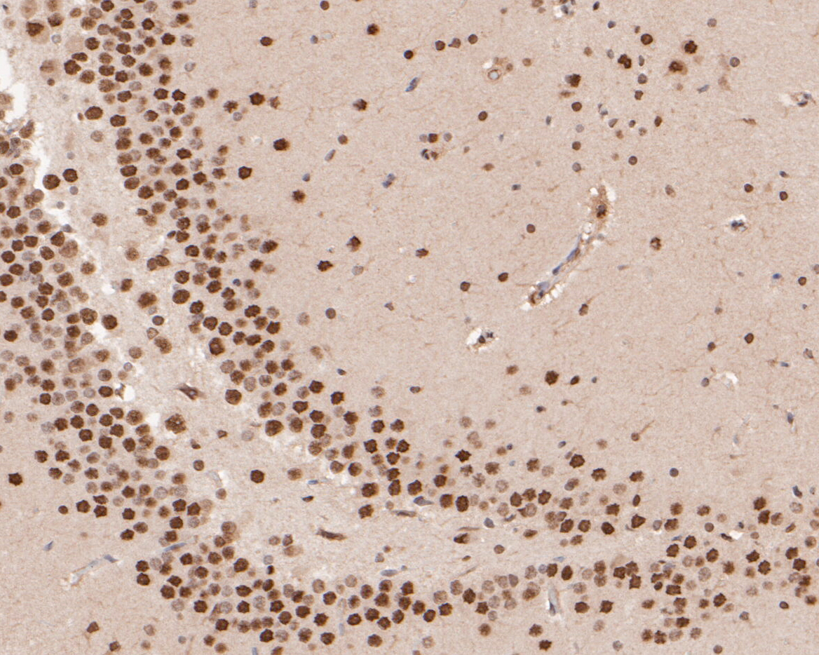 Immunohistochemical analysis of paraffin-embedded rat brian tissue using anti-LIM1 antibody. The section was pre-treated using heat mediated antigen retrieval with sodium citrate buffer (pH 6.0) for 20 minutes. The tissues were blocked in 5% BSA for 30 minutes at room temperature, washed with ddH2O and PBS, and then probed with the primary antibody (ER1902-83, 1/200)  for 30 minutes at room temperature. The detection was performed using an HRP conjugated compact polymer system. DAB was used as the chromogen. Tissues were counterstained with hematoxylin and mounted with DPX.