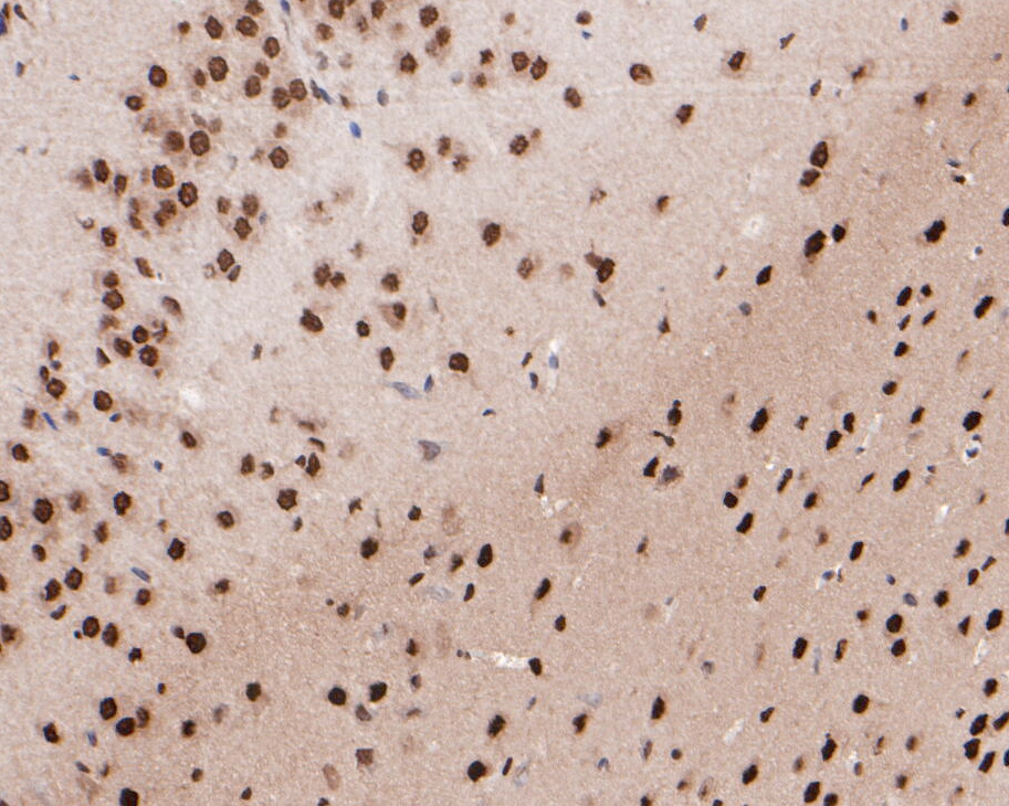 Immunohistochemical analysis of paraffin-embedded mouse brian tissue using anti-LIM1 antibody. The section was pre-treated using heat mediated antigen retrieval with sodium citrate buffer (pH 6.0) for 20 minutes. The tissues were blocked in 5% BSA for 30 minutes at room temperature, washed with ddH2O and PBS, and then probed with the primary antibody (ER1902-83, 1/200)  for 30 minutes at room temperature. The detection was performed using an HRP conjugated compact polymer system. DAB was used as the chromogen. Tissues were counterstained with hematoxylin and mounted with DPX.