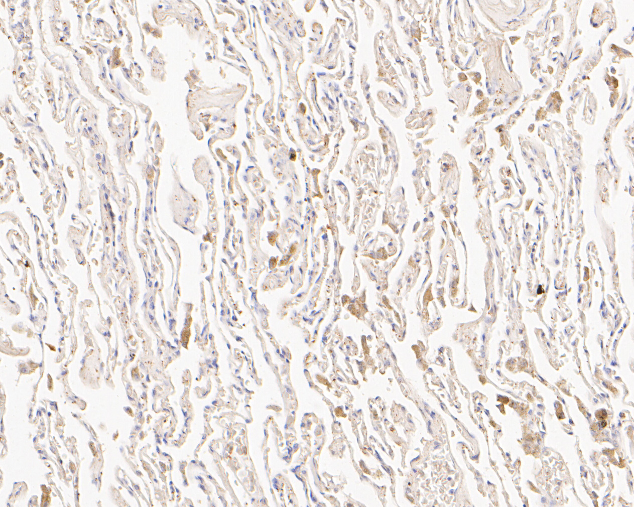 Immunohistochemical analysis of paraffin-embedded human lung tissue using anti-SLFN12 antibody. The section was pre-treated using heat mediated antigen retrieval with Tris-EDTA buffer (pH 8.0-8.4) for 20 minutes.The tissues were blocked in 5% BSA for 30 minutes at room temperature, washed with ddH2O and PBS, and then probed with the primary antibody (ER1902-84, 1/200) for 30 minutes at room temperature. The detection was performed using an HRP conjugated compact polymer system. DAB was used as the chromogen. Tissues were counterstained with hematoxylin and mounted with DPX.