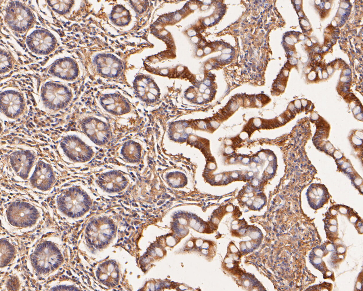 Immunohistochemical analysis of paraffin-embedded human small intestine tissue using anti-SLFN12 antibody. The section was pre-treated using heat mediated antigen retrieval with Tris-EDTA buffer (pH 8.0-8.4) for 20 minutes.The tissues were blocked in 5% BSA for 30 minutes at room temperature, washed with ddH2O and PBS, and then probed with the primary antibody (ER1902-84, 1/50) for 30 minutes at room temperature. The detection was performed using an HRP conjugated compact polymer system. DAB was used as the chromogen. Tissues were counterstained with hematoxylin and mounted with DPX.