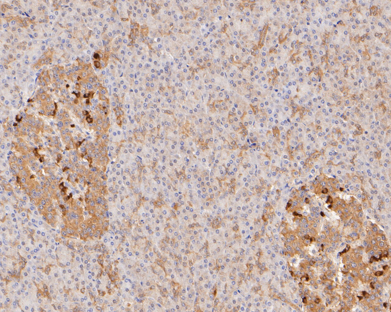 Immunohistochemical analysis of paraffin-embedded human pancreas tissue using anti-SLFN12 antibody. The section was pre-treated using heat mediated antigen retrieval with Tris-EDTA buffer (pH 8.0-8.4) for 20 minutes.The tissues were blocked in 5% BSA for 30 minutes at room temperature, washed with ddH2O and PBS, and then probed with the primary antibody (ER1902-84, 1/50) for 30 minutes at room temperature. The detection was performed using an HRP conjugated compact polymer system. DAB was used as the chromogen. Tissues were counterstained with hematoxylin and mounted with DPX.