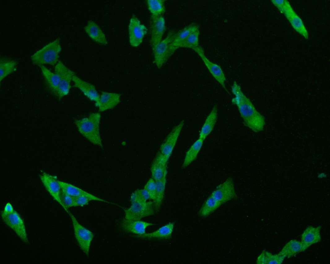 ICC staining of Claudin18.2 in MG-63 cells (green). Formalin fixed cells were permeabilized with 0.1% Triton X-100 in TBS for 10 minutes at room temperature and blocked with 10% negative goat serum for 15 minutes at room temperature. Cells were probed with the primary antibody (ER1902-86, 1/50) for 1 hour at room temperature, washed with PBS. Alexa Fluor®488 conjugate-Goat anti-Rabbit IgG was used as the secondary antibody at 1/1,000 dilution. The nuclear counter stain is DAPI (blue).