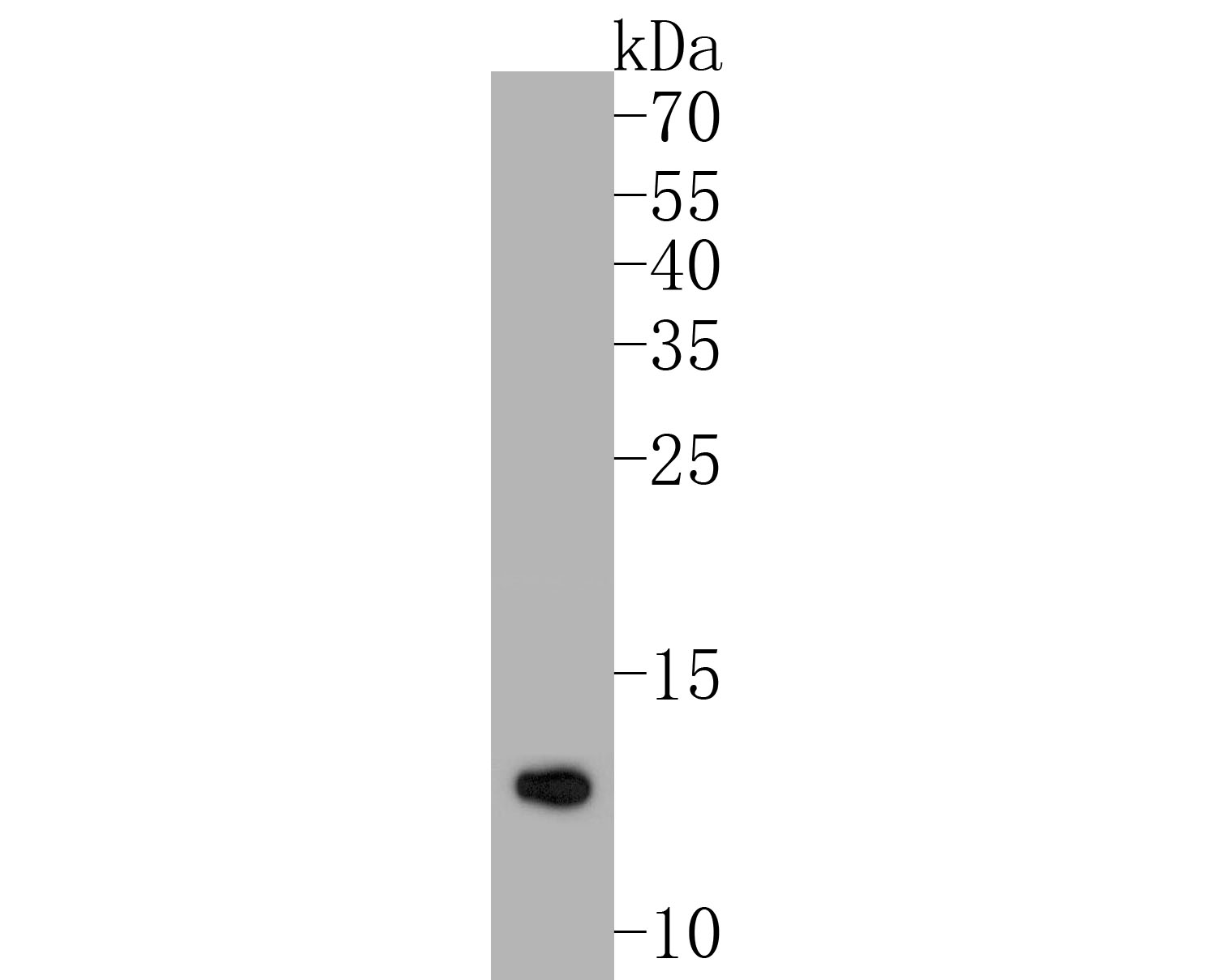 Western blot analysis of COX5B on 293 cell lysates. Proteins were transferred to a PVDF membrane and blocked with 5% BSA in PBS for 1 hour at room temperature. The primary antibody (ER1902-87, 1/500) was used in 5% BSA at room temperature for 2 hours. Goat Anti-Rabbit IgG - HRP Secondary Antibody (HA1001) at 1:5,000 dilution was used for 1 hour at room temperature.