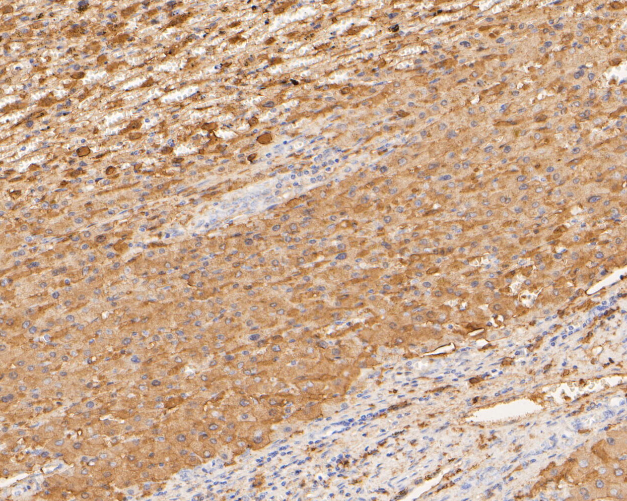 Immunohistochemical analysis of paraffin-embedded human liver tissue using anti-COX5B antibody. The section was pre-treated using heat mediated antigen retrieval with Tris-EDTA buffer (pH 8.0-8.4) for 20 minutes.The tissues were blocked in 5% BSA for 30 minutes at room temperature, washed with ddH2O and PBS, and then probed with the primary antibody (ER1902-87, 1/200) for 30 minutes at room temperature. The detection was performed using an HRP conjugated compact polymer system. DAB was used as the chromogen. Tissues were counterstained with hematoxylin and mounted with DPX.
