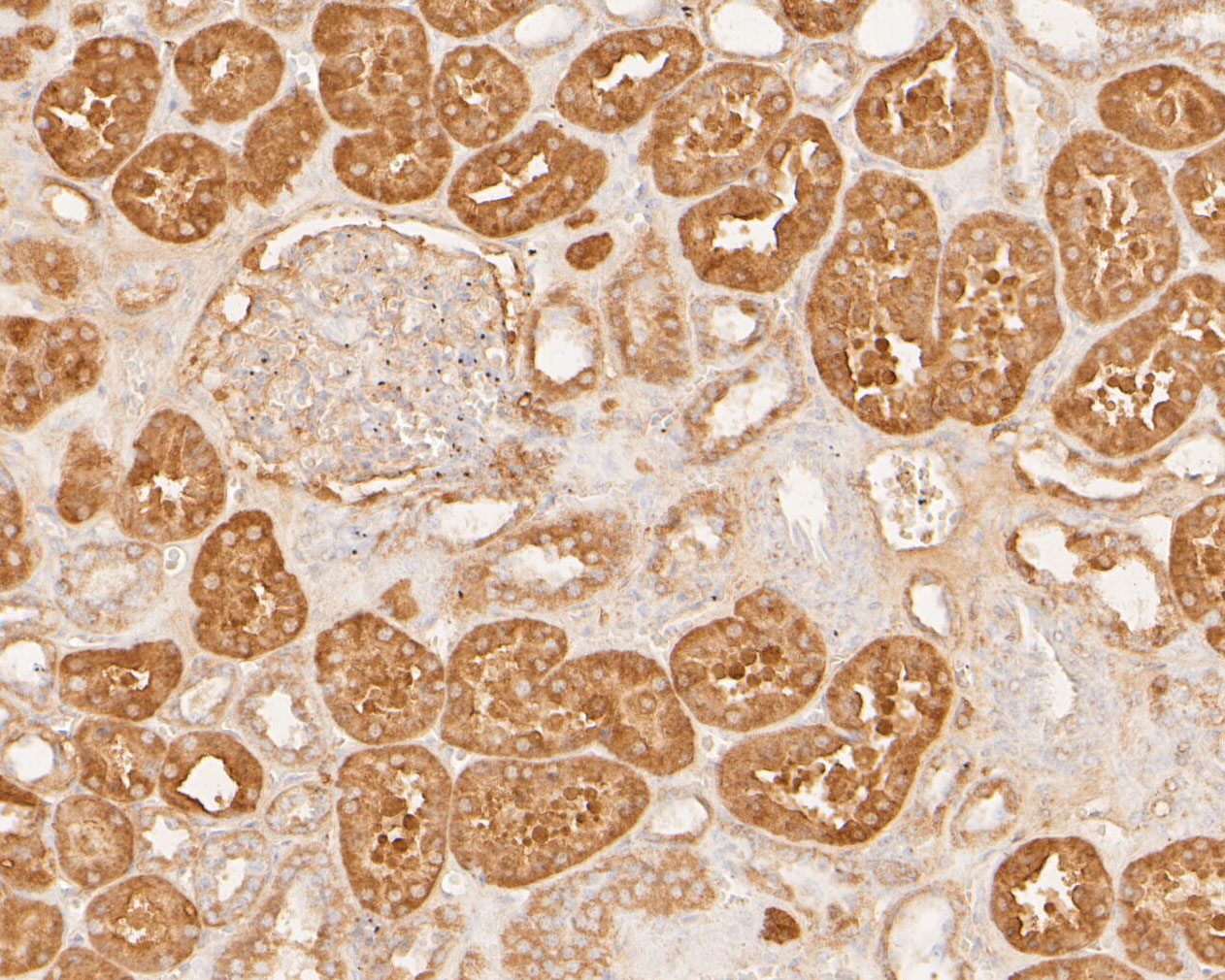 Immunohistochemical analysis of paraffin-embedded human kidney tissue using anti-COX5B antibody. The section was pre-treated using heat mediated antigen retrieval with Tris-EDTA buffer (pH 8.0-8.4) for 20 minutes.The tissues were blocked in 5% BSA for 30 minutes at room temperature, washed with ddH2O and PBS, and then probed with the primary antibody (ER1902-87, 1/50) for 30 minutes at room temperature. The detection was performed using an HRP conjugated compact polymer system. DAB was used as the chromogen. Tissues were counterstained with hematoxylin and mounted with DPX.