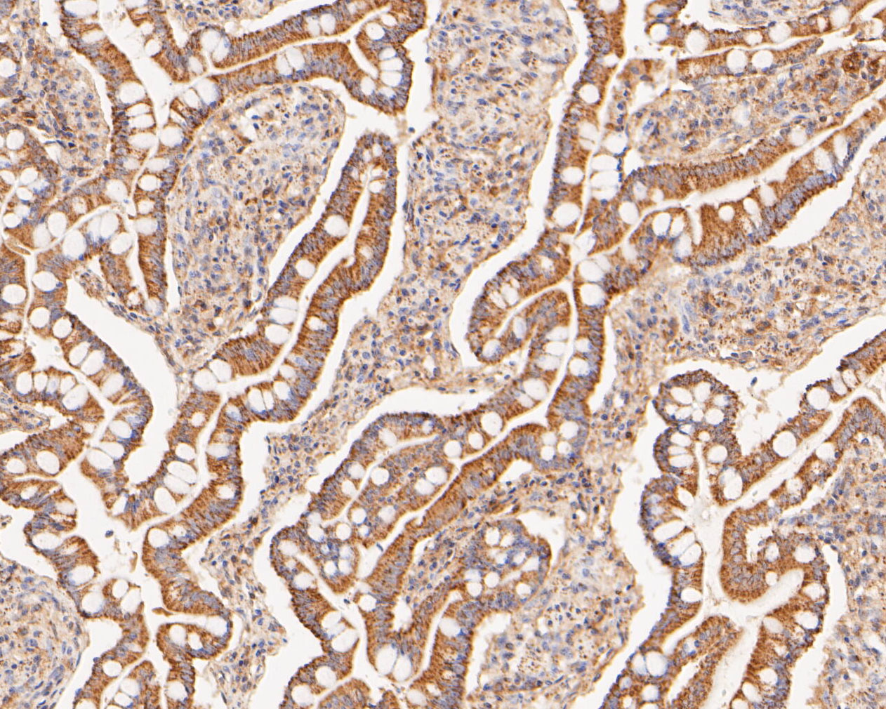 Immunohistochemical analysis of paraffin-embedded human small intestine tissue using anti-COX5B antibody. The section was pre-treated using heat mediated antigen retrieval with Tris-EDTA buffer (pH 8.0-8.4) for 20 minutes.The tissues were blocked in 5% BSA for 30 minutes at room temperature, washed with ddH2O and PBS, and then probed with the primary antibody (ER1902-87, 1/200) for 30 minutes at room temperature. The detection was performed using an HRP conjugated compact polymer system. DAB was used as the chromogen. Tissues were counterstained with hematoxylin and mounted with DPX.