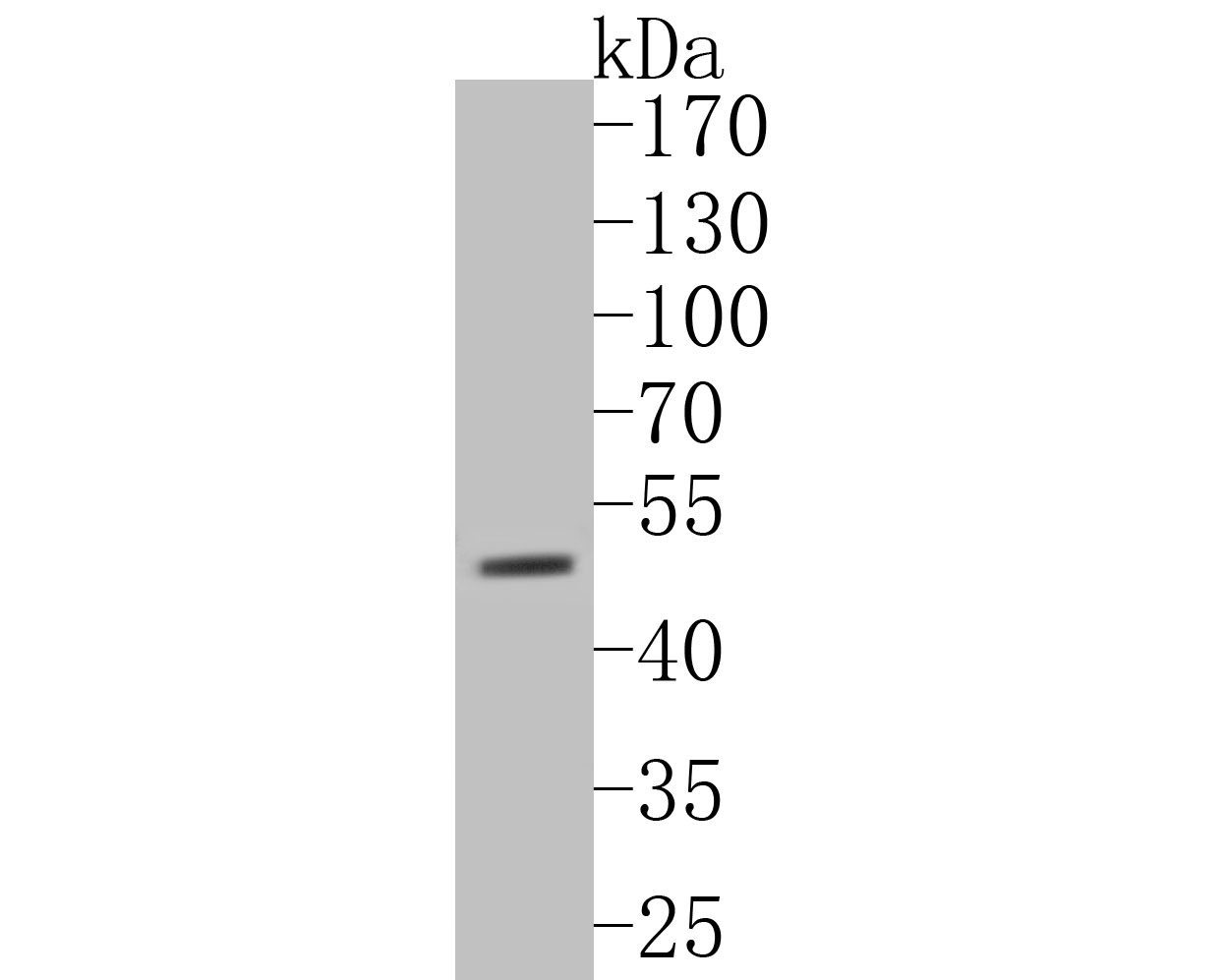 Western blot analysis of P2X3 on mouse testis tissue lysates. Proteins were transferred to a PVDF membrane and blocked with 5% BSA in PBS for 1 hour at room temperature. The primary antibody (ER1902-88, 1/500) was used in 5% BSA at room temperature for 2 hours. Goat Anti-Rabbit IgG - HRP Secondary Antibody (HA1001) at 1:5,000 dilution was used for 1 hour at room temperature.