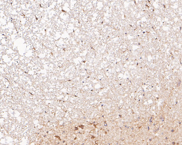 Immunohistochemical analysis of paraffin-embedded rat spinal cord tissue using anti-P2X3 antibody. The section was pre-treated using heat mediated antigen retrieval with Tris-EDTA buffer (pH 8.0-8.4) for 20 minutes.The tissues were blocked in 5% BSA for 30 minutes at room temperature, washed with ddH2O and PBS, and then probed with the primary antibody (ER1902-88, 1/200) for 30 minutes at room temperature. The detection was performed using an HRP conjugated compact polymer system. DAB was used as the chromogen. Tissues were counterstained with hematoxylin and mounted with DPX.