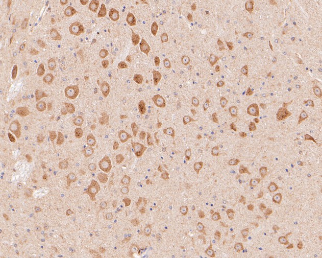 Immunohistochemical analysis of paraffin-embedded mouse brain tissue using anti-P2X3 antibody. The section was pre-treated using heat mediated antigen retrieval with Tris-EDTA buffer (pH 8.0-8.4) for 20 minutes.The tissues were blocked in 5% BSA for 30 minutes at room temperature, washed with ddH2O and PBS, and then probed with the primary antibody (ER1902-88, 1/200) for 30 minutes at room temperature. The detection was performed using an HRP conjugated compact polymer system. DAB was used as the chromogen. Tissues were counterstained with hematoxylin and mounted with DPX.