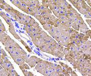 Immunohistochemical analysis of paraffin-embedded mouse heart tissue using anti-TNNT2 antibody. Counter stained with hematoxylin.