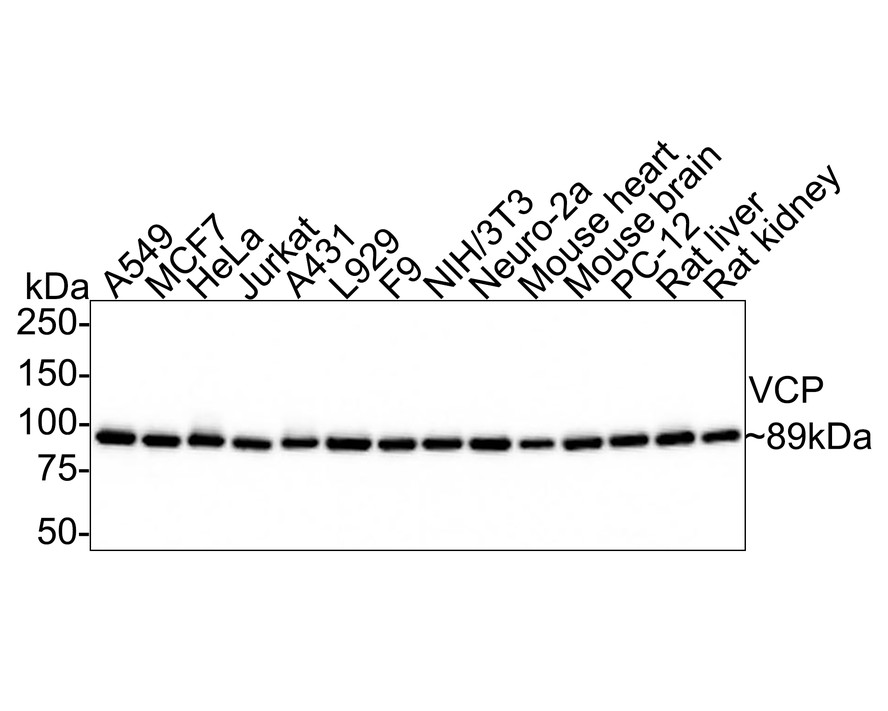 Western blot analysis of VCP on different cell lysates using anti- VCP antibody at 1/2000 dilution.<br />
Positive control:    <br />
Lane 1: L929           <br />
Lane 2: F9  <br />
Lane 3: A549           <br />
Lane 4: MCF-7  <br />
Lane 5: Hela           <br />
Lane 6: NIH/3T3  <br />
Lane 7: N2A            <br />
Lane 8: Jurkat  <br />
Lane 9: HepG2          <br />
Lane 10: A431  <br />
Lane 11: Mouse heart  <br />
 Lane 12: Mouse brain  <br />
Lane 13: Mouse liver   <br />
Lane 14: Mouse kidney