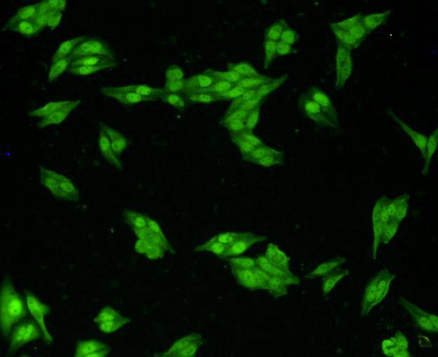 ICC staining VCP in Hela cells (green). Cells were fixed in paraformaldehyde, permeabilised with 0.25% Triton X100/PBS.