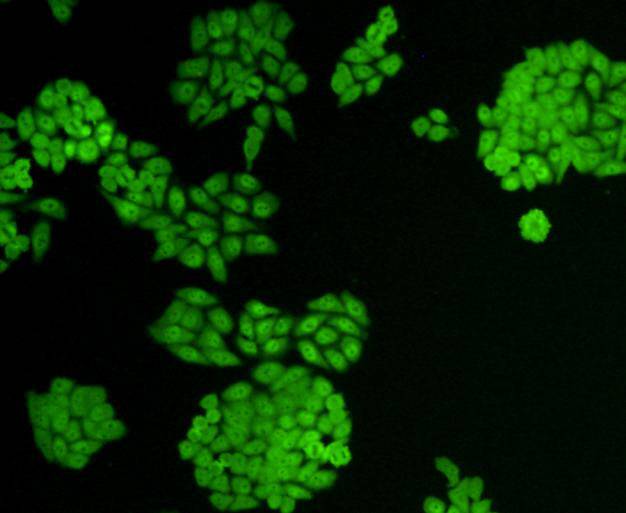 ICC staining VCP in HepG2 cells (green). Cells were fixed in paraformaldehyde, permeabilised with 0.25% Triton X100/PBS.