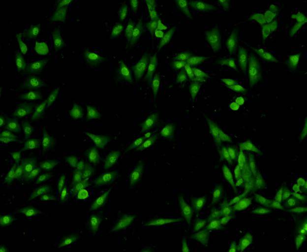 ICC staining VCP in SHG-44 cells (green). Cells were fixed in paraformaldehyde, permeabilised with 0.25% Triton X100/PBS.