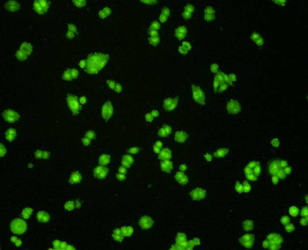 ICC staining VCP in SW480 cells (green). Cells were fixed in paraformaldehyde, permeabilised with 0.25% Triton X100/PBS.
