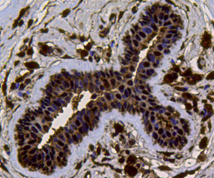 Immunohistochemical analysis of paraffin-embedded mouse skeletal muscle tissue using anti-VCP antibody. Counter stained with hematoxylin.