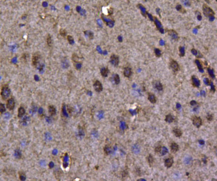 Immunohistochemical analysis of paraffin-embedded mouse heart tissue using anti-VCP antibody. Counter stained with hematoxylin.