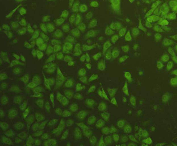 ICC staining VEGF in HUVEC cells (green). Cells were fixed in paraformaldehyde, permeabilised with 0.25% Triton X100/PBS.