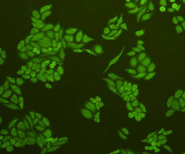 ICC staining of Caspase-3 in HepG2 cells (green). Cells were fixed in paraformaldehyde, permeabilised with 0.25% Triton X100/PBS.