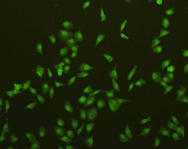 ICC staining of Caspase-3 in A549 cells (green). Cells were fixed in paraformaldehyde, permeabilised with 0.25% Triton X100/PBS.