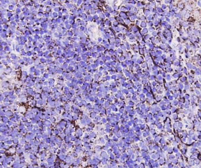 Immunohistochemical analysis of paraffin-embedded human tonsil tissue using anti-Caspase-3 antibody. Counter stained with hematoxylin.