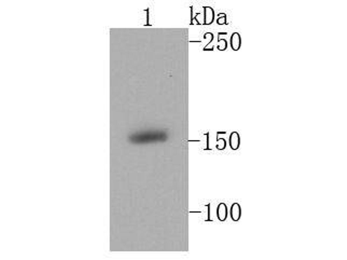 Western blot analysis of MSH6 on A431 cell lysates using anti-MSH6 antibody at 1/1000 dilution.