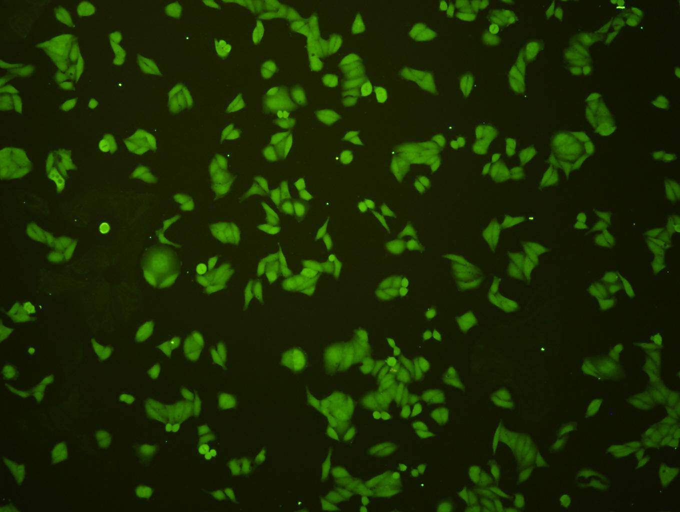 ICC staining MSH6 in Hela cells (green). Cells were fixed in paraformaldehyde, permeabilised with 0.25% Triton X100/PBS.