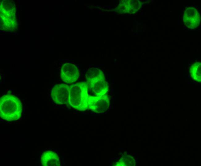 ICC staining IKK alpha in N2A cells (green). Cells were fixed in paraformaldehyde, permeabilised with 0.25% Triton X100/PBS.