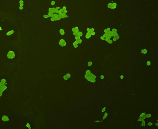 ICC staining p70 S6 Kinase beta in  Lovo cells (green). Cells were fixed in paraformaldehyde, permeabilised with 0.25% Triton X100/PBS.