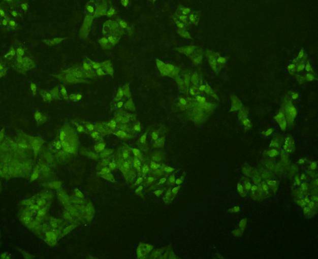 ICC staining p70 S6 Kinase beta in Hela cells (green). Cells were fixed in paraformaldehyde, permeabilised with 0.25% Triton X100/PBS.