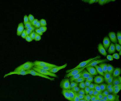 ICC staining of TGF-Beta 1 in HepG2 cells (green). Formalin fixed cells were permeabilized with 0.1% Triton X-100 in TBS for 10 minutes at room temperature and blocked with 10% negative goat serum for 15 minutes at room temperature. Cells were probed with the primary antibody (ER31210, 1/50) for 1 hour at room temperature, washed with PBS. Alexa Fluor®488 conjugate-Goat anti-Rabbit IgG was used as the secondary antibody at 1/1,000 dilution. The nuclear counter stain is DAPI (blue).
