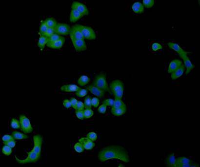 ICC staining of TGF-Beta 1 in SK-Br-3 cells (green). Formalin fixed cells were permeabilized with 0.1% Triton X-100 in TBS for 10 minutes at room temperature and blocked with 10% negative goat serum for 15 minutes at room temperature. Cells were probed with the primary antibody (ER31210, 1/50) for 1 hour at room temperature, washed with PBS. Alexa Fluor®488 conjugate-Goat anti-Rabbit IgG was used as the secondary antibody at 1/1,000 dilution. The nuclear counter stain is DAPI (blue).